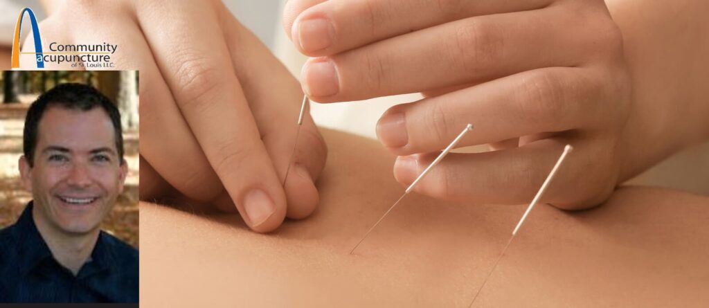 Community Acupuncture's John Schmieder presents on the topic of acupuncture treatment and fertility