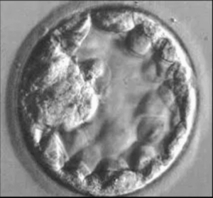 A microscope picture of a fertilized embryo