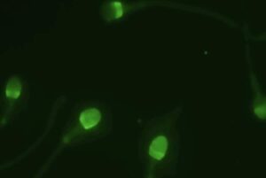 Sperm under fluroscence microscopy